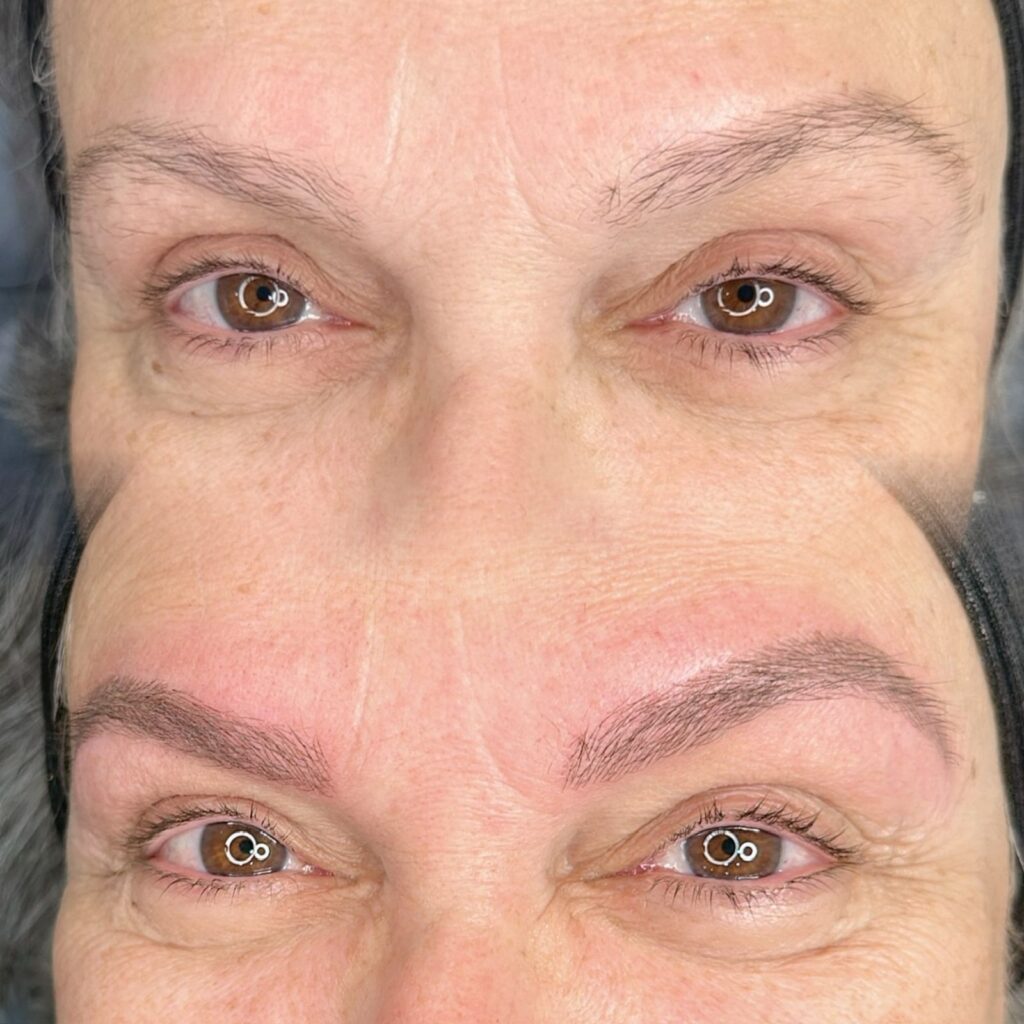 Procedimento Studio Pâmela Moura em Indaiatuba